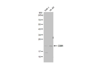 Anti-CD81 antibody used in Western Blot (WB). GTX101766