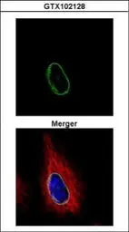 Anti-POM121 antibody [N2N3] used in Immunocytochemistry/ Immunofluorescence (ICC/IF). GTX102128
