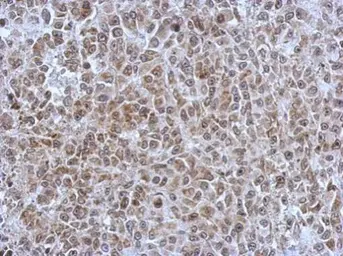 Anti-POM121 antibody [N2N3] used in IHC (Paraffin sections) (IHC-P). GTX102128