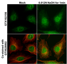 Anti-Cofilin 1 antibody used in Immunocytochemistry/ Immunofluorescence (ICC/IF). GTX102156