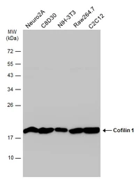 Anti-Cofilin 1 antibody used in Western Blot (WB). GTX102156