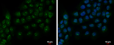 Anti-PAF49 antibody used in Immunocytochemistry/ Immunofluorescence (ICC/IF). GTX102175