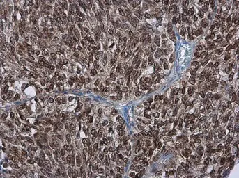 Anti-PAF49 antibody used in IHC (Paraffin sections) (IHC-P). GTX102175