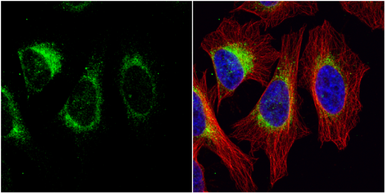 Anti-Tyrosine Hydroxylase antibody [N1C1] used in Immunocytochemistry/ Immunofluorescence (ICC/IF). GTX102424
