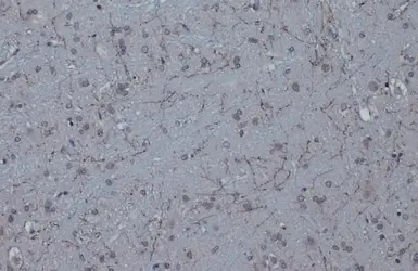 Anti-Tyrosine Hydroxylase antibody [N1C1] used in IHC (Paraffin sections) (IHC-P). GTX102424