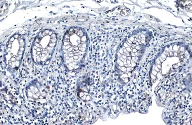 Anti-Desmoglein 2 antibody [N1N2], N-term used in IHC (Paraffin sections) (IHC-P). GTX102508