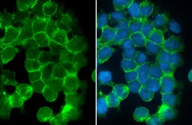 Anti-Desmoglein 2 antibody [N1N2], N-term used in Immunocytochemistry/ Immunofluorescence (ICC/IF). GTX102508