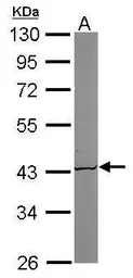 Anti-ACAT1 antibody [N1N3] used in Western Blot (WB). GTX102637