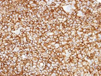 Anti-CD13 antibody used in IHC (Paraffin sections) (IHC-P). GTX102788