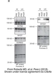 Anti-alpha Actinin 2 antibody [N1N3] used in Western Blot (WB). GTX103219