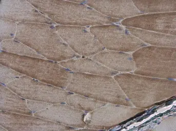 Anti-alpha Actinin 2 antibody [N1N3] used in IHC (Paraffin sections) (IHC-P). GTX103219