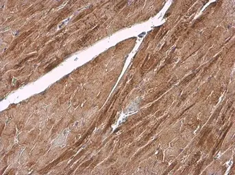 Anti-alpha Actinin 2 antibody [N1N3] used in IHC (Paraffin sections) (IHC-P). GTX103219
