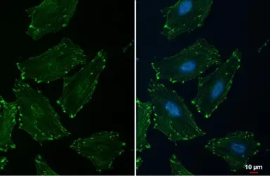 Anti-alpha Actinin 2 antibody [N1N3] used in Immunocytochemistry/ Immunofluorescence (ICC/IF). GTX103219