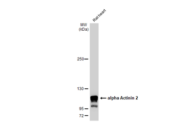 Anti-alpha Actinin 2 antibody [N1N3] used in Western Blot (WB). GTX103219