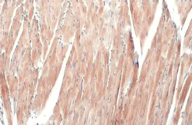 Anti-alpha Actinin 2 antibody [N1N3] used in IHC (Paraffin sections) (IHC-P). GTX103219