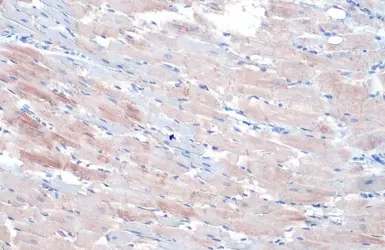 Anti-alpha Actinin 2 antibody [N1N3] used in IHC (Paraffin sections) (IHC-P). GTX103219