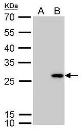 Anti-Calretinin antibody used in Western Blot (WB). GTX103261