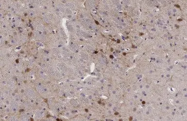 Anti-Calretinin antibody used in IHC (Paraffin sections) (IHC-P). GTX103261