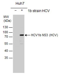Anti-Hepatitis C virus NS3 protein antibody used in Western Blot (WB). GTX103356