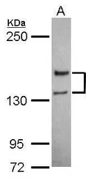 Anti-NMDAR2A antibody used in Western Blot (WB). GTX103558