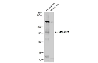 Anti-NMDAR2A antibody used in Western Blot (WB). GTX103558