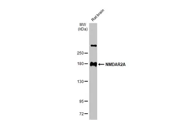 Anti-NMDAR2A antibody used in Western Blot (WB). GTX103558