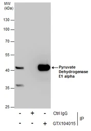 Anti-Pyruvate Dehydrogenase E1 alpha antibody used in Immunoprecipitation (IP). GTX104015