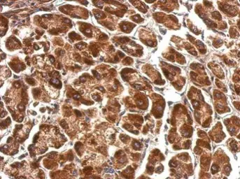 Anti-Pyruvate Dehydrogenase E1 alpha antibody used in IHC (Paraffin sections) (IHC-P). GTX104015