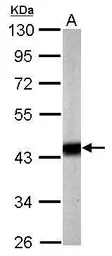 Anti-Pyruvate Dehydrogenase E1 alpha antibody used in Western Blot (WB). GTX104015