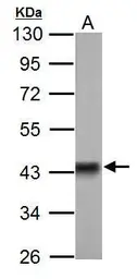 Anti-Pyruvate Dehydrogenase E1 alpha antibody used in Western Blot (WB). GTX104015