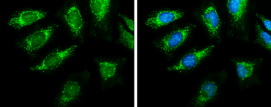 Anti-Pyruvate Dehydrogenase E1 alpha antibody used in Immunocytochemistry/ Immunofluorescence (ICC/IF). GTX104015