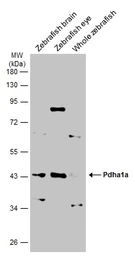 Anti-Pyruvate Dehydrogenase E1 alpha antibody used in Western Blot (WB). GTX104015