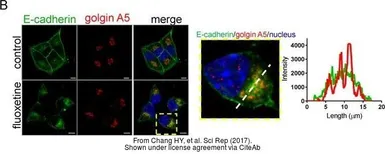 Anti-GOLGA5 antibody [N2C2], Internal used in Immunocytochemistry/ Immunofluorescence (ICC/IF). GTX104255