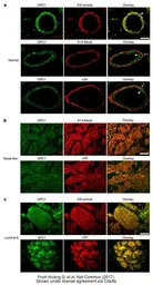 Anti-Glypican 1 antibody [N3C3] used in IHC (Paraffin sections) (IHC-P). GTX104557