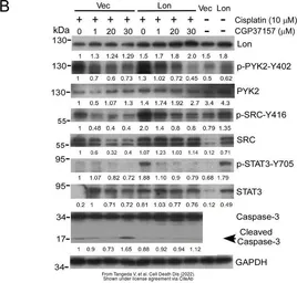 Anti-STAT3 antibody [C3], C-term used in Western Blot (WB). GTX104616