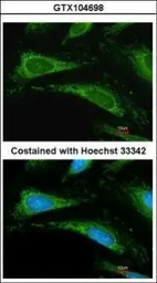 Anti-Cyclophilin A antibody [C1C3] used in Immunocytochemistry/ Immunofluorescence (ICC/IF). GTX104698
