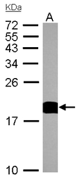 Anti-Cyclophilin A antibody [C1C3] used in Western Blot (WB). GTX104698