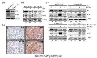 Anti-PD-L1 antibody used in Western Blot (WB). GTX104763