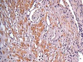 Anti-IDH1 antibody used in IHC (Paraffin sections) (IHC-P). GTX105179