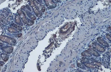 Anti-IDH1 antibody used in IHC (Paraffin sections) (IHC-P). GTX105179
