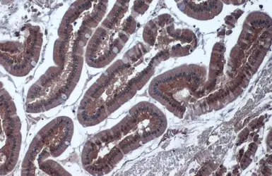 Anti-IDH1 antibody used in IHC (Paraffin sections) (IHC-P). GTX105179