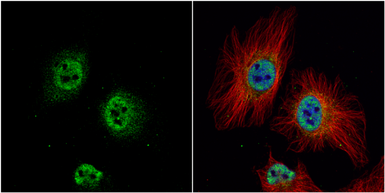 Anti-ZWINT antibody used in Immunocytochemistry/ Immunofluorescence (ICC/IF). GTX107155