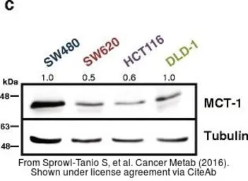 Anti-beta Tubulin antibody used in Western Blot (WB). GTX107175