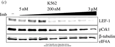 Anti-beta Tubulin antibody used in Western Blot (WB). GTX107175