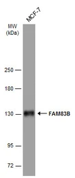 Anti-FAM83B antibody [N1N2], N-term used in Western Blot (WB). GTX107222