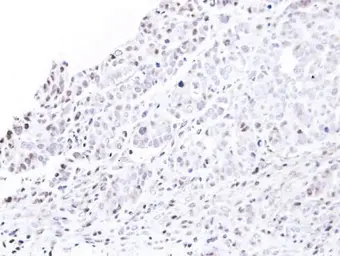 Anti-Nucleoporin p62 antibody used in IHC (Paraffin sections) (IHC-P). GTX107973