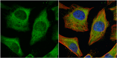 Anti-PKM antibody used in Immunocytochemistry/ Immunofluorescence (ICC/IF). GTX107977