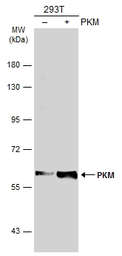 Anti-PKM antibody used in Western Blot (WB). GTX107977