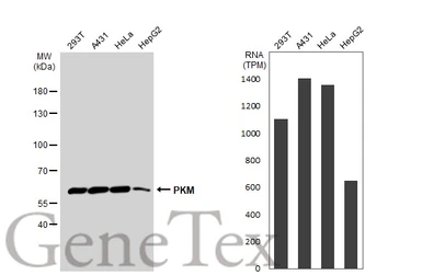 Anti-PKM antibody used in Western Blot (WB). GTX107977