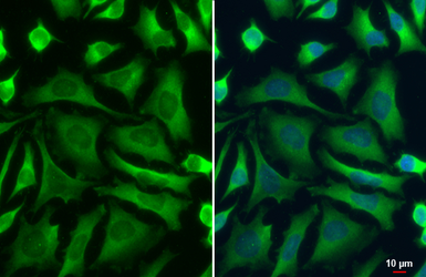 Anti-PKM antibody used in Immunocytochemistry/ Immunofluorescence (ICC/IF). GTX107977